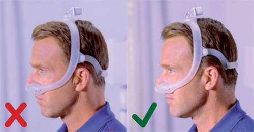 Philips DreamWear - Maske zu gro&szlig;