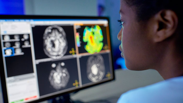 Philips Symposium im Rahmen der DGNR &Ouml;GNR neuroRAD 2025