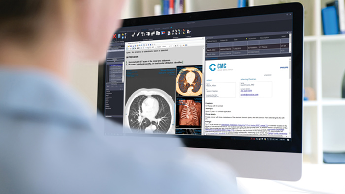 Berichterstellung und Ergebniskommunikation