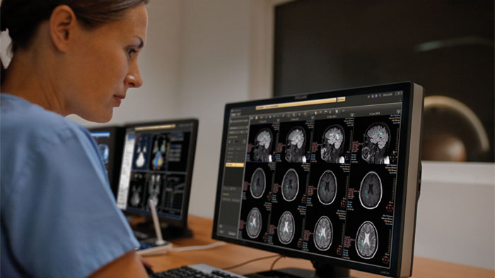 IntelliSpace Portal&nbsp;9.0