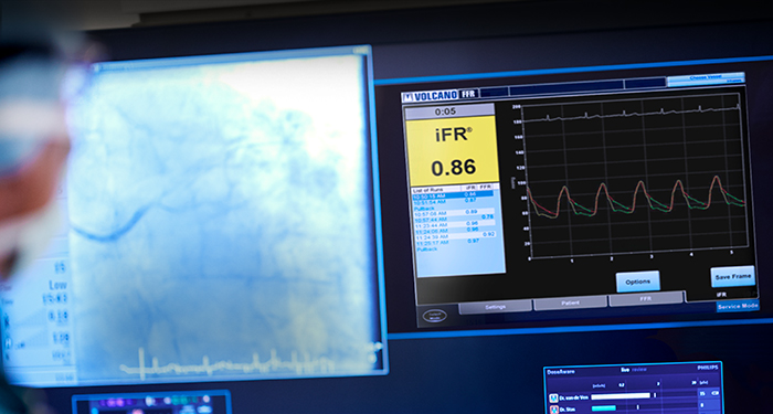 Computerbildschirm mit einem Diagramm und einer Tabelle