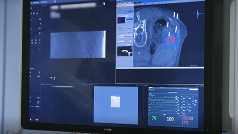 Philips Azurion&nbsp;7 C20 Kundenerfahrungsbericht St. Antonius Nieuwegein, Niederlande