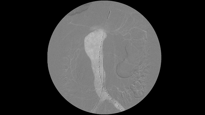 Optionen f&uuml;r Jod- und CO2-Kontrastmittel