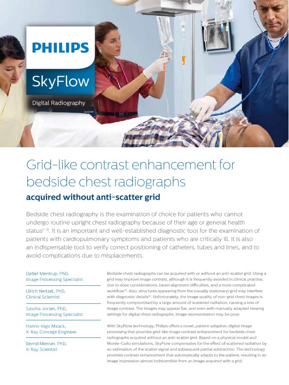 Whitepaper Philips SkyFlow (Download .pdf)