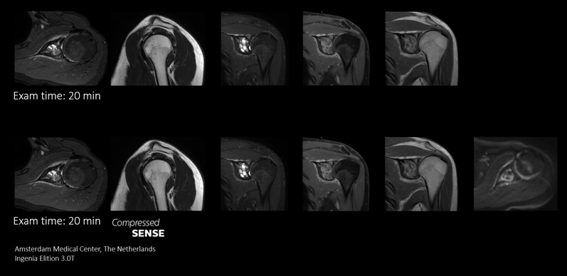 Zus&auml;tzliche Sequenzen Scan
