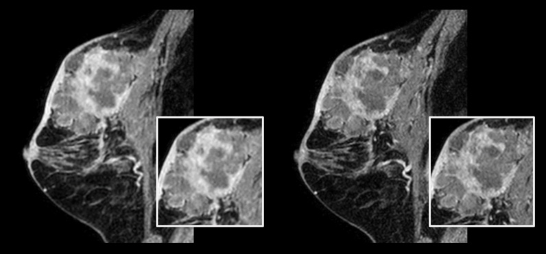 Verbesserte Aufl&ouml;sung Scan