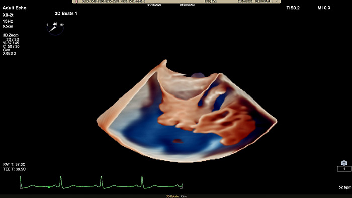EPIQ&nbsp;CVx&nbsp;&ndash; TrueVue Glass