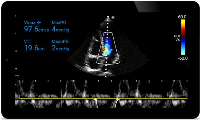 Schneller reagieren, das Herz sch&uuml;tzen