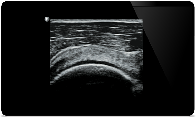 Schnelle Reaktionen mit Bildgebung des ganzen K&ouml;rpers