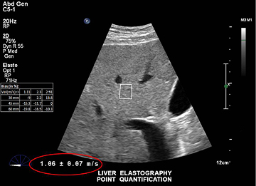 eine Nahaufnahme eines Ultraschalls
