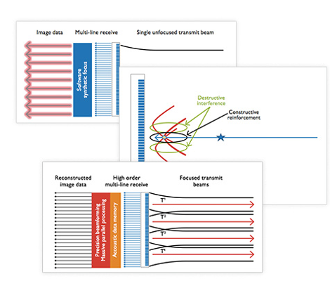 Whitepaper &uuml;ber Philips nSight Imaging​