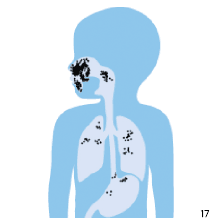 Masque disposant d'une mauvaise &eacute;tanch&eacute;it&eacute;