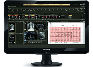 &Eacute;lectrocardiographe des patients suivi par le syst&egrave;me d&rsquo;information cardiovasculaire de Philips