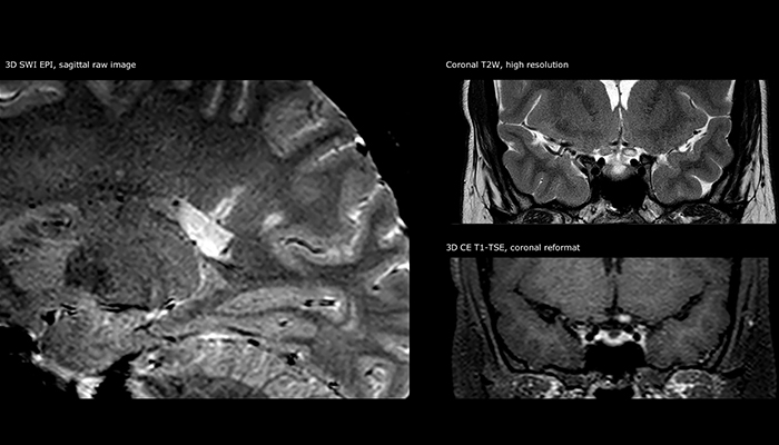 eine Nahaufnahme eines Gehirnscans