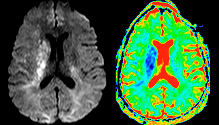 eine Nahaufnahme eines Gehirnscans