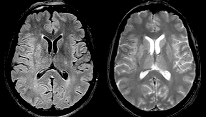 eine Nahaufnahme eines Gehirnscans