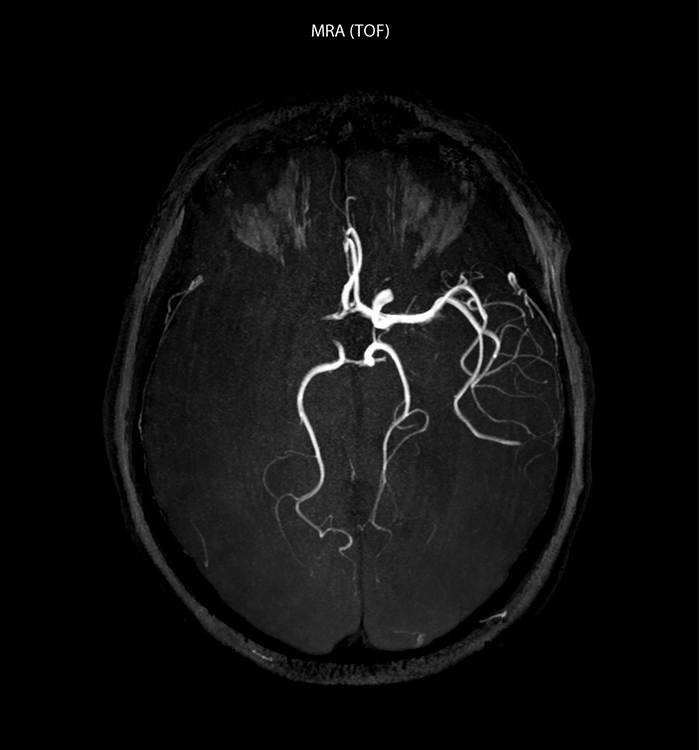 eine Nahaufnahme eines Gehirnscans