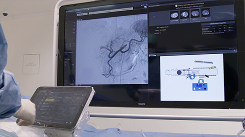Interventionelle Radiologie&nbsp;&ndash; Video