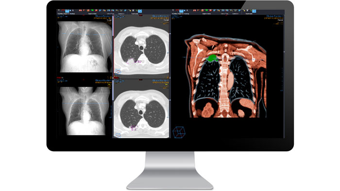 Benutzeroberfl&auml;che des radiologischen Diagnosemoduls auf einem Monitor