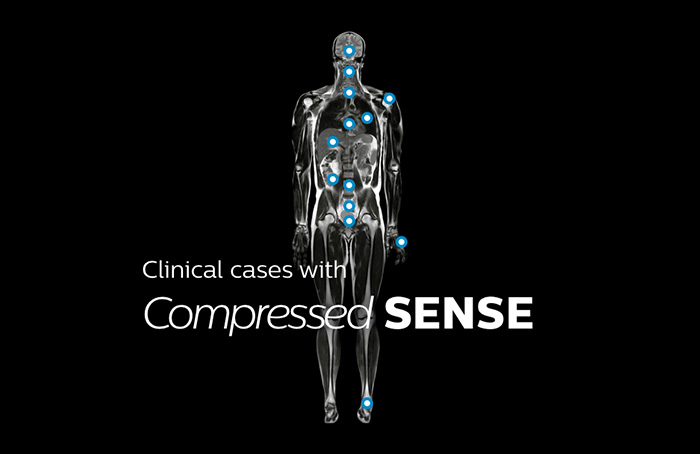 Computer, Tablet und Mobiltelefon mit MR Body Map-Seite f&uuml;r klinische Fallbeispiele f&uuml;r nahezu jede Anatomie