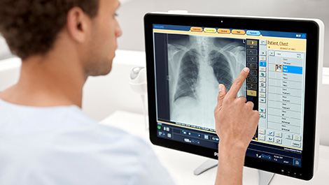 ECR 2021: Philips stellt KI-gest&uuml;tzte L&ouml;sungen f&uuml;r die R&ouml;ntgendiagnostik vor